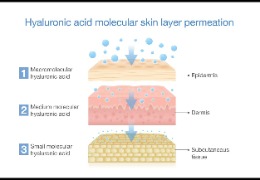 如何選擇適合油痘肌的精華產品？